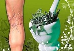 ervas para o tratamento de varizes