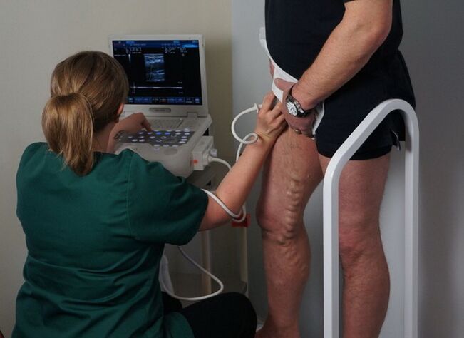 exame de veias antes da coagulação a laser para varizes