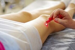 tratamento a laser para varizes